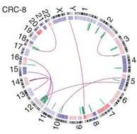 DNA structural rearrangements and copy number alterations detected in a colorectal tumors displayed as a CIRCOS plot. Source: Nature Genetics